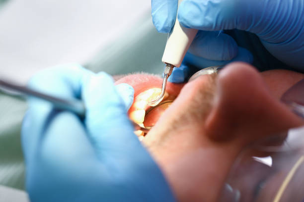 Best Broken or Cracked Tooth Emergency Dentist in Atkinson, NE